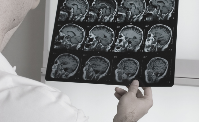 Responsabilità sanitaria e giudizio controfattuale