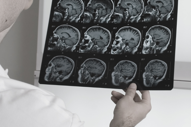 Responsabilità sanitaria e giudizio controfattuale Responsabilità sanitaria e giudizio controfattuale